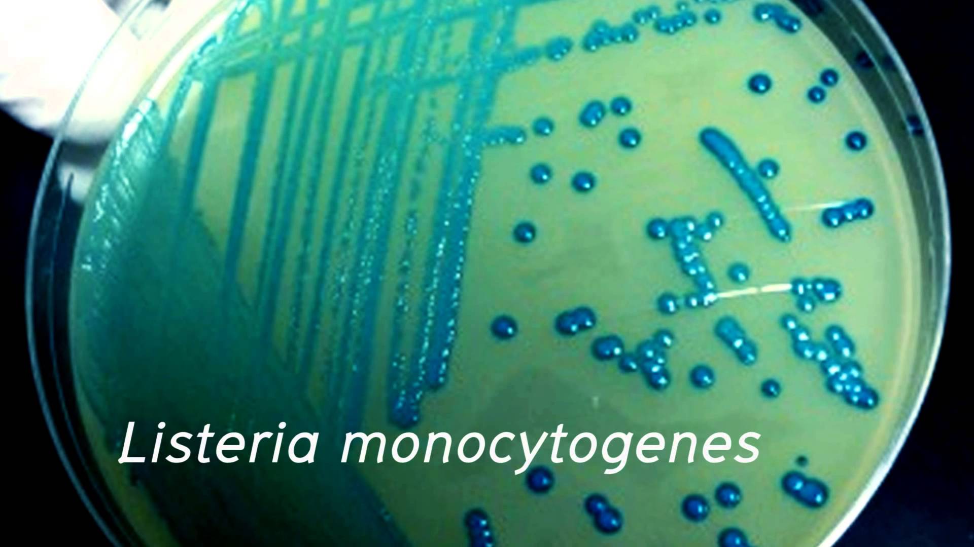 Listeria monocytogenes - bakterije