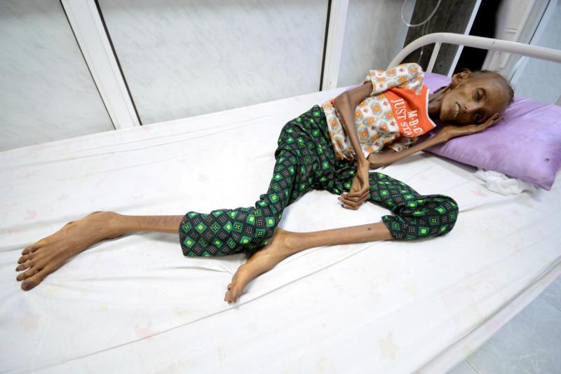 ZN svarijo pred hudo lakoto v Jemnu zaradi blokade Savdske Arabije