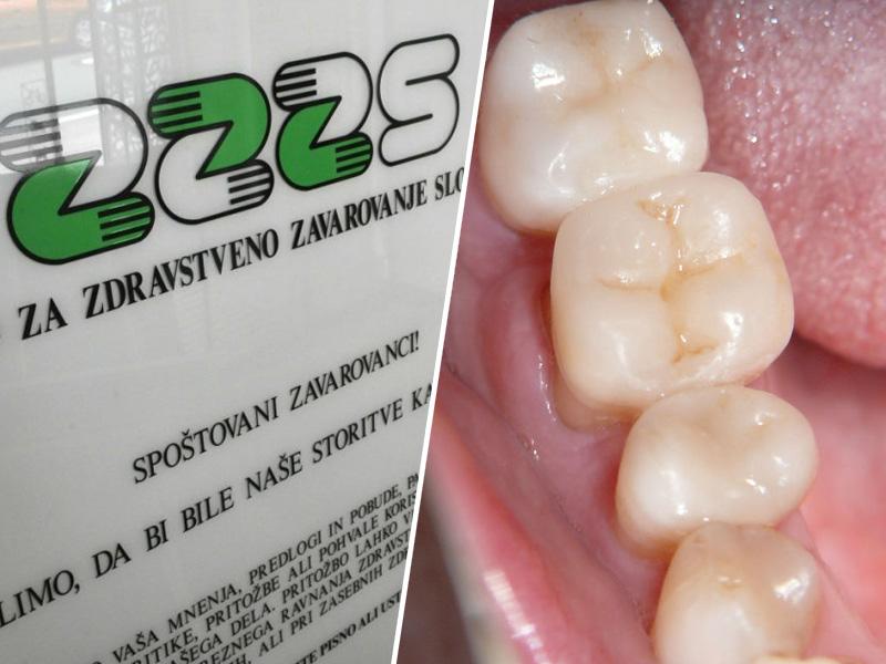 ZZZS predpisala uporabo belih zalivk za otroke in nosečnice, kljub opozorilom zobozdravnikov