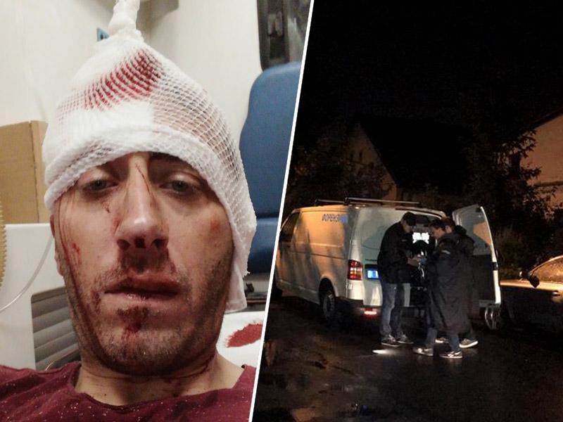 V Banjaluki pretepli novinarja