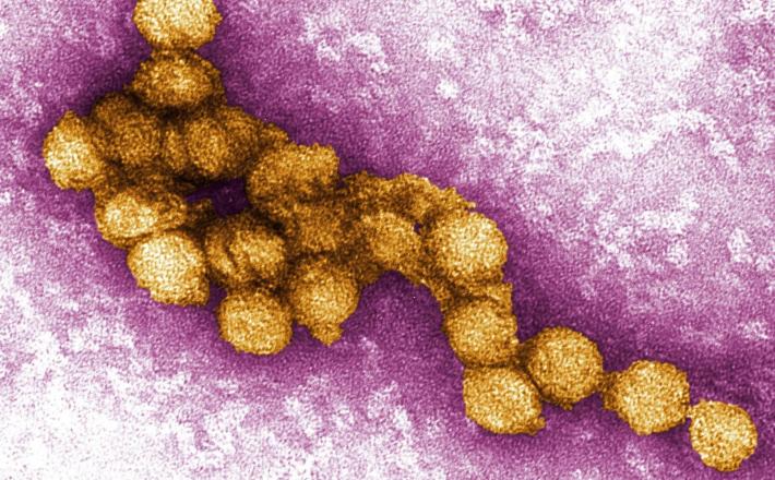 Virus Zahodnega Nila